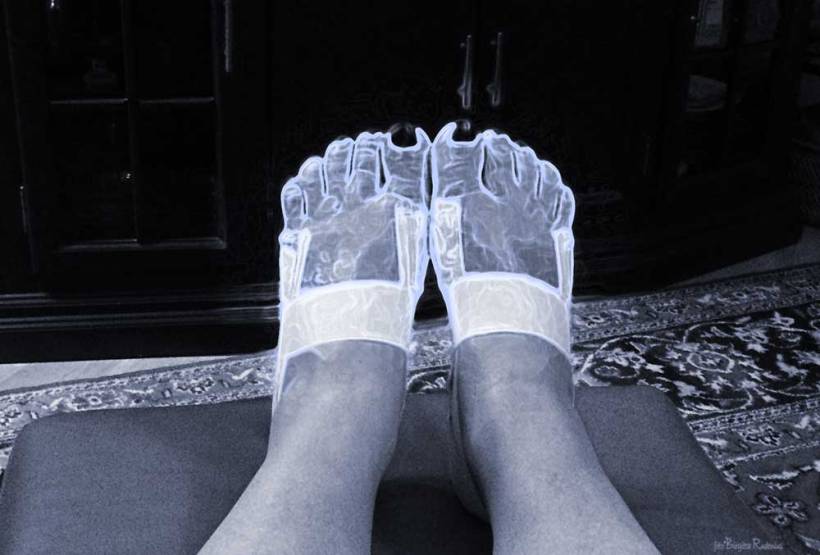 Blue Artros Feet